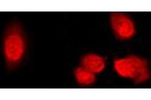 Immunofluorescent analysis of Histone Deacetylase 5 (pS498) staining in Raw264. (HDAC5 抗体  (pSer498))