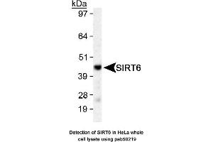 Image no. 1 for anti-Sirtuin 6 (SIRT6) (AA 300-355), (C-Term) antibody (ABIN363528) (SIRT6 抗体  (C-Term))
