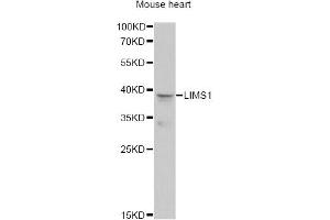 Western blot analysis of extracts of mouse heart, using LIMS1 antibody (ABIN6293172) at 1:1000 dilution. (LIMS1 抗体)