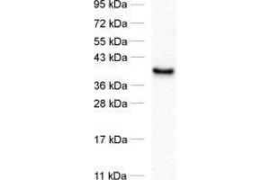 dilution: 1 : 1000, sample: synaptosomal fraction of rat brain (P2) (PTPLAD1 抗体)
