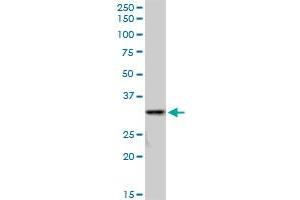 Western Blotting (WB) image for anti-Sulfotransferase Family, Cytosolic, 1A, Phenol-Preferring, Member 3 (SULT1A3) (AA 1-295) antibody (ABIN520608)