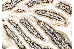 ABIN6264528 and ABIN6266732 at 1/100 staining Mouse colorectal tissue by IHC-P. (PTTG1 抗体  (Internal Region))