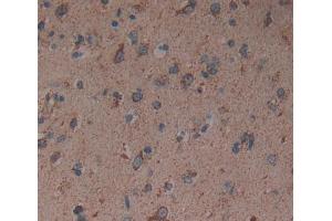Used in DAB staining on fromalin fixed paraffin- embedded brain tissue (GABRA2 抗体  (AA 42-250))