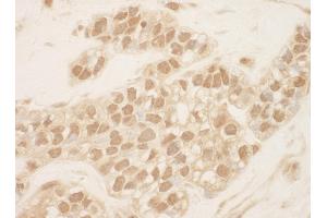 anti-Cullin 2 (CUL2) (AA 150-200) antibody
