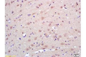 Formalin-fixed and paraffin embedded rat brain labeled with Rabbit Anti Trk A/B/C Polyclonal Antibody, Unconjugated (ABIN726095) at 1:200 followed by conjugation to the secondary antibody and DAB staining (TrkA, B, C (AA 668-750) 抗体)