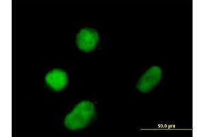 Immunofluorescence of purified MaxPab antibody to ZNF131 on Daoy cell. (ZNF131 抗体  (AA 1-510))