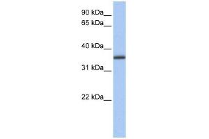 GALE antibody used at 1 ug/ml to detect target protein. (GALE 抗体  (N-Term))