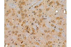 ABIN6257637 and ABIN6274779 at 1/100 staining Rat brain tissue by IHC-P. (RPL34 抗体)