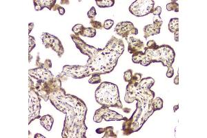 IHC analysis of MCUR1 using anti-MCUR1 antibody (ABIN6719261).