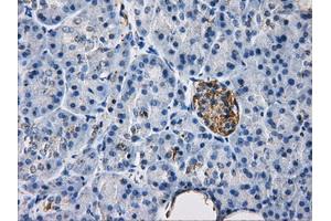 Immunohistochemical staining of paraffin-embedded liver tissue using anti-HDAC10mouse monoclonal antibody. (HDAC10 抗体)