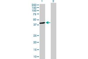Western Blot analysis of HOMER2 expression in transfected 293T cell line by HOMER2 MaxPab polyclonal antibody. (HOMER2 抗体  (AA 1-343))