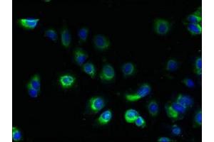 Immunofluorescent analysis of MCF-7 cells using ABIN7173019 at dilution of 1:100 and Alexa Fluor 488-congugated AffiniPure Goat Anti-Rabbit IgG(H+L) (TRAPPC10 抗体  (AA 1-55))