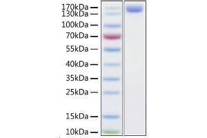 SDS-PAGE (SDS) image for Angiotensin I Converting Enzyme 2 (ACE2) (AA 18-740) (Active) protein (Fc Tag) (ABIN6952744)