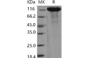 Western Blotting (WB) image for Vinculin (VCL) protein (His tag) (ABIN7198696) (Vinculin Protein (VCL) (His tag))