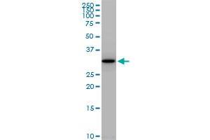 PLSCR1 polyclonal antibody (A01), Lot # 060814QCS1. (PLSCR1 抗体  (AA 1-318))