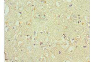 Immunohistochemistry of paraffin-embedded human brain tissue using ABIN7148555 at dilution of 1:100 (ATP7B 抗体  (AA 1166-1465))