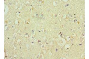 Immunohistochemistry of paraffin-embedded human brain tissue using ABIN7148555 at dilution of 1:100
