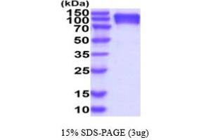SDS-PAGE (SDS) image for Carcinoembryonic Antigen-Related Cell Adhesion Molecule 5 (CEACAM5) (AA 35-685) protein (His tag) (ABIN7529361) (CEACAM5 Protein (AA 35-685) (His tag))