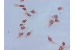 Immunocytochemistry analysis of Hela cells using ABIN7139167 at dilution of 1:100 (HIST1H4A 抗体  (acLys16))