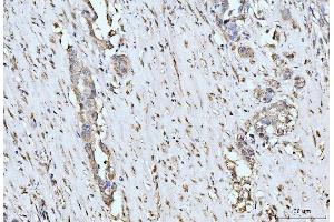 IHC analysis of MOV10 using anti-MOV10 antibody (ABIN7600236). (MOV10 抗体  (AA 167-772))