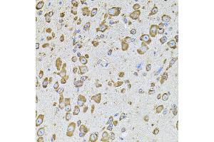 Immunohistochemistry of paraffin-embedded mouse brain using CYBB antibody. (CYBB 抗体)