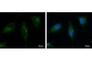 ICC/IF Image PKD2 antibody [C1C3] detects PKD2 protein at cytoplasm by immunofluorescent analysis. (PKD2 抗体)