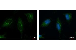 ICC/IF Image PKD2 antibody [C1C3] detects PKD2 protein at cytoplasm by immunofluorescent analysis. (PKD2 抗体)