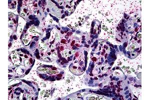 Anti-ARID3A antibody IHC of human placenta. (ARID3A 抗体  (AA 317-417))