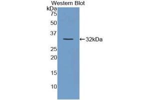 Western Blotting (WB) image for anti-Versican (Vcan) (AA 3058-3299) antibody (ABIN7434116)