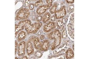 Immunohistochemical staining of human kidney with LTV1 polyclonal antibody  shows moderate cytoplasmic and membranous positivity in cells in tubules at 1:500-1:1000 dilution. (LTV1 抗体)