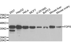 Western blot analysis of extracts of various cell lines, using FDPS antibody. (FDPS 抗体)