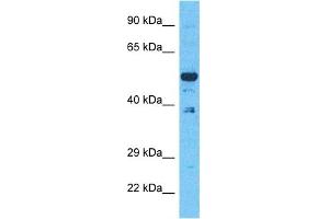 Host:  Rabbit  Target Name:  EVI2B  Sample Type:  293T Whole Cell lysates  Antibody Dilution:  1. (EVI2B 抗体  (C-Term))
