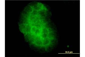 Immunofluorescence of monoclonal antibody to KLK10 on A-431 cell. (Kallikrein 10 抗体  (AA 167-276))