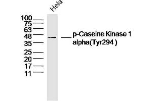 Hela lysates probed with Casein Kinase 1 alpha (Tyr294) Antibody, Unconjugated  at 1:300 dilution and 4˚C overnight incubation. (CSNK1A1 抗体  (pTyr294))