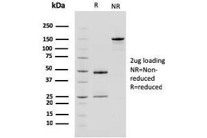 SDS-PAGE (SDS) image for anti-Carboxypeptidase A1 (Pancreatic) (CPA1) antibody (ABIN6939174)