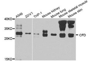 Western blot analysis of extract of various cells, using CFD antibody. (Adipsin 抗体)