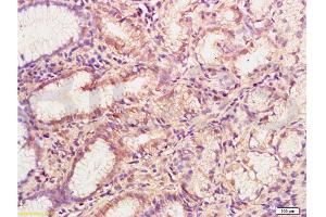 Formalin-fixed and paraffin embedded human gastric mucosa labeled with Anti-MMP-3 Polyclonal Antibody , Unconjugated at 1:200, followed by conjugation to the secondary antibody and DAB staining (MMP3 抗体  (AA 401-477))
