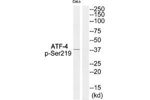 Western blot analysis of extracts from COLO cells using ATF-4 (Phospho-Ser219) Antibody. (ATF4 抗体  (pSer219))