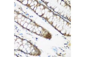 Immunohistochemistry of paraffin-embedded human colon using NCBP2 antibody at dilution of 1:200 (40x lens). (NCBP2 抗体)