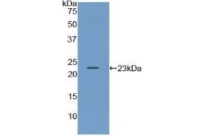 Western blot analysis of recombinant Mouse Iga. (CD79a 抗体  (AA 30-193))