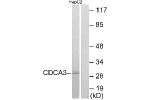 Immunohistochemistry analysis of paraffin-embedded human colon carcinoma tissue using CDCA3 antibody. (CDCA3 抗体)