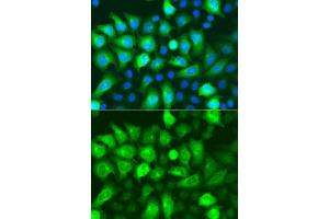 Immunofluorescence analysis of A549 cells using RRM2 antibody (ABIN5973030). (RRM2 抗体)