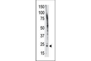 The anti-Bid BH3 domain Pab (ABIN388099 and ABIN2846183) is used in Western blot to detect Bid BH3 in HL-60 cell lysate. (BID 抗体  (AA 68-103))