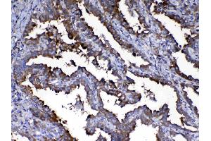 IHC analysis of Calpain 2 using anti-Calpain 2 antibody . (Calpain 2 抗体  (AA 500-700))