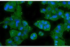 IF analysis of CA2 using anti-CA2 antibody (ABIN6719533). (CA2 抗体  (AA 2-260))