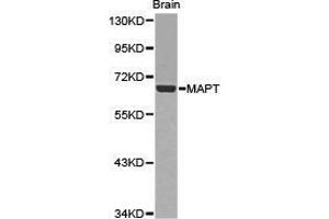 Western Blotting (WB) image for anti-Microtubule-Associated Protein tau (MAPT) antibody (ABIN1873639) (MAPT 抗体)
