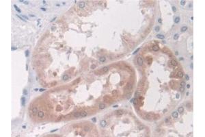 Detection of LDHD in Human Kidney Tissue using Polyclonal Antibody to Lactate Dehydrogenase D (LDHD) (LDHD 抗体  (AA 62-265))