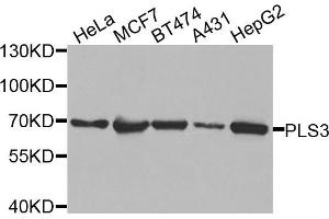 Western blot analysis of extracts of various cells, using PLS3 antibody. (Plastin 3 抗体)