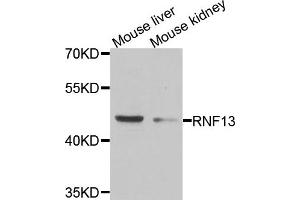 Western blot analysis of extracts of mouse liver and mouse kidney cell lines, using RNF13 antibody. (RNF13 抗体)