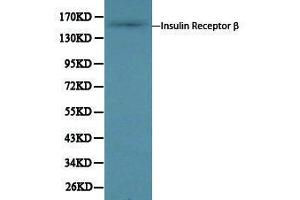 Western Blotting (WB) image for anti-Insulin Receptor beta (ISR-beta) antibody (ABIN1873245) (ISR-beta 抗体)